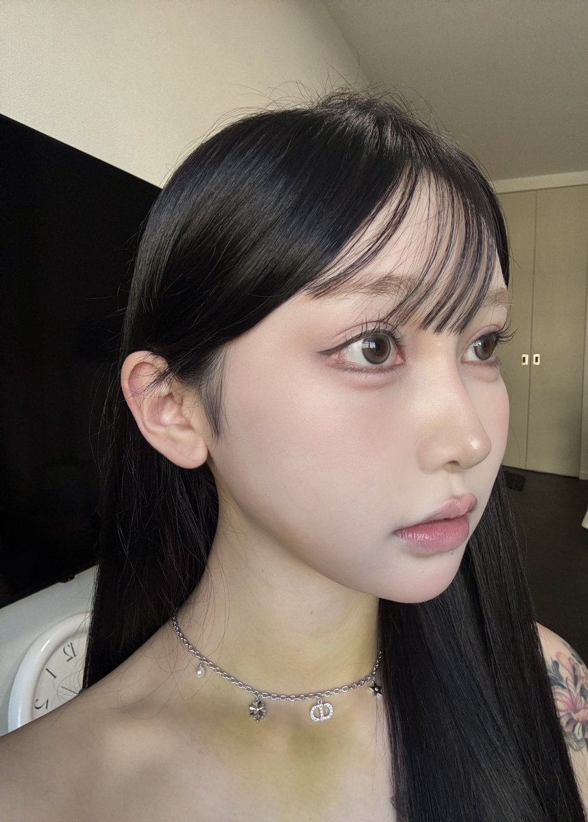 mhrso2's tweet photo. ワイヤング美容外科でエラ顎の輪郭2点してから7日目ෆ  ̇ᵕ  ̇ ෆ
韓国にいる間はクリニックで腫れケアのレーザーと注射をしてもらえて、日本帰ってきてからは酸素カプセルに通っているから腫れ引くのはやい気がする！でもまだまだ腫れてる下膨れ！あと首にアザが降りてきて黄色🌼⭐️😼 https://t.co/3hSJLvWiRA