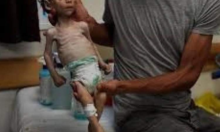 ارتفاع ضحايا منتظري المساعدات في غزة إلى 2,140 شهيدًا وأكثر من 15,737 إصابة

أعلنت وزارة الصحة في قطاع غزة اليوم الثلاثاء أنه بلغ عدد ما وصل إلى المستشفيات خلال الـ24 ساعة الماضية من شهداء المساعدات 17 شهيدًا و 122 إصابة،

وأوضحت في بيان انه بذلك يرتفع إجمالي شهداء لقمة العيش ممن