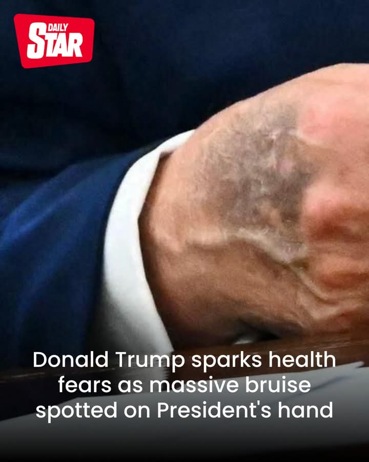 Seems his hand won't heal as fast as the ear_ because this is real_ his ear never was shot _:; or his head would of blown off like the innocent man_ behind him!