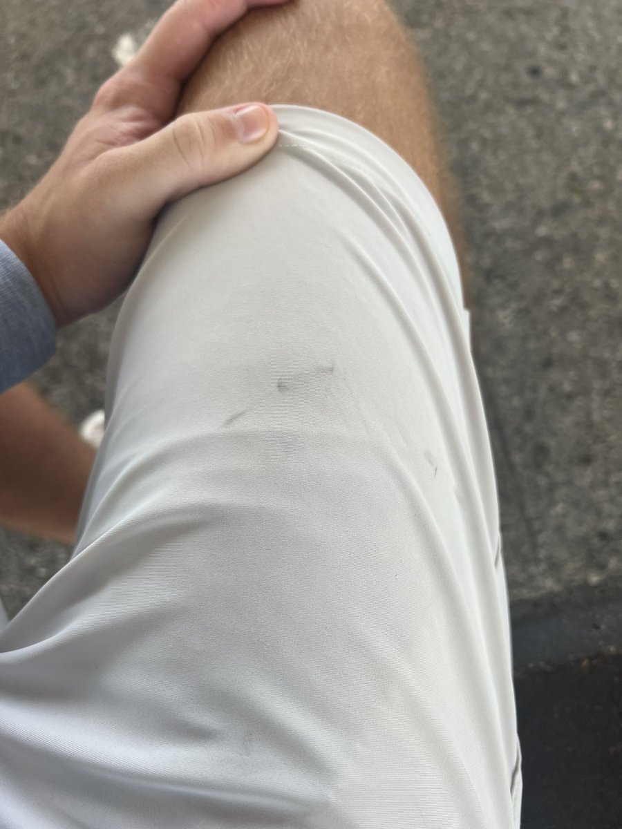 Where the fuck do these black marks come from??? May be the greatest scientific debate of our time