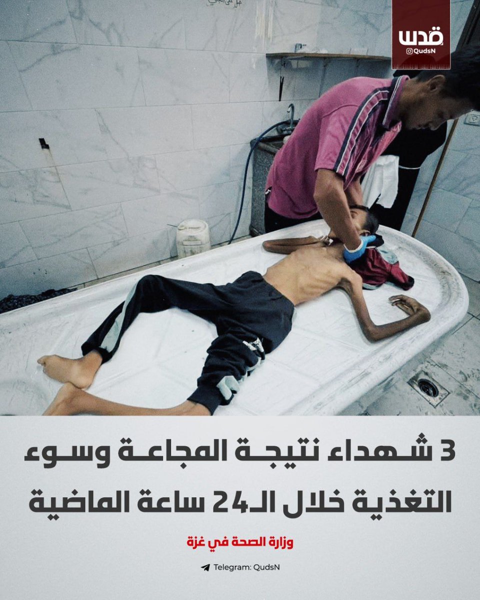 وزارة الصحة في غزة: 3 شهداء نتيجة المجاعة وسوء التغذية خلال الـ24 ساعة الماضية، وجميعهم من البالغين