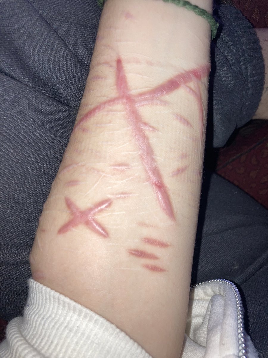 The cut and the scar😞