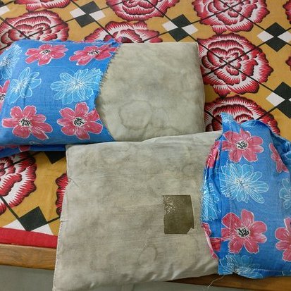 If you pillow is like this, it because sweat, saliva, dust mites, mold spores, and dead skin cells accumulate in it which can trigger acne, allergies, asthma and chronic sinus infections.

Replace pillows every 1–2 years and wash pillowcases weekly for healthier skin and lungs.🛏️