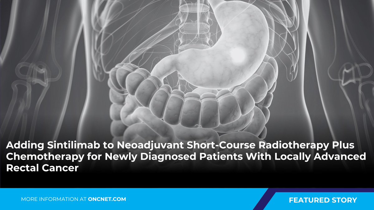 OncLearnNetwork's tweet image. According to results from the phase 2 #SPRING01 trial, the addition of #sintilimab to short-course radiotherapy plus chemo significantly improved pCR among newly diagnosed patients with locally advanced rectal cancer. Learn more: hmpgloballearningnetwork.com/site/onc/news/…

#medtwitter #onctwitter