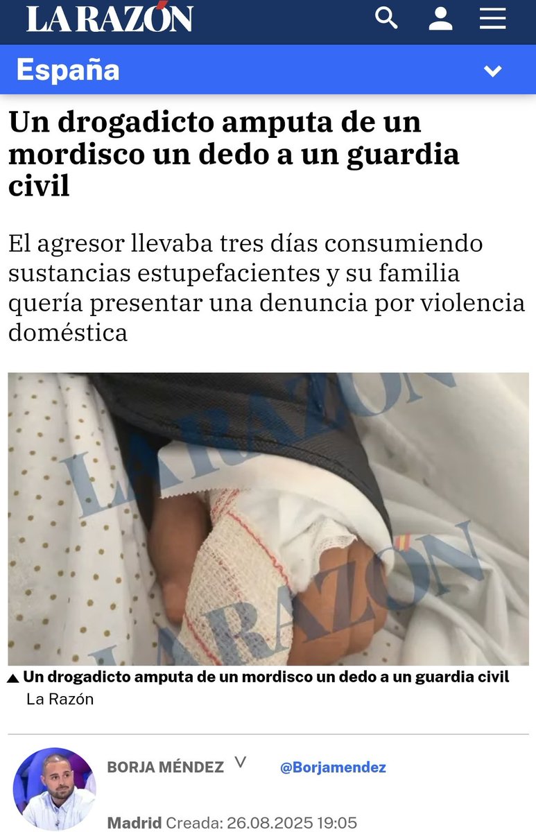 Le han amputado el dedo a mordiscos al guardia porque no es una profesión de riesgo.