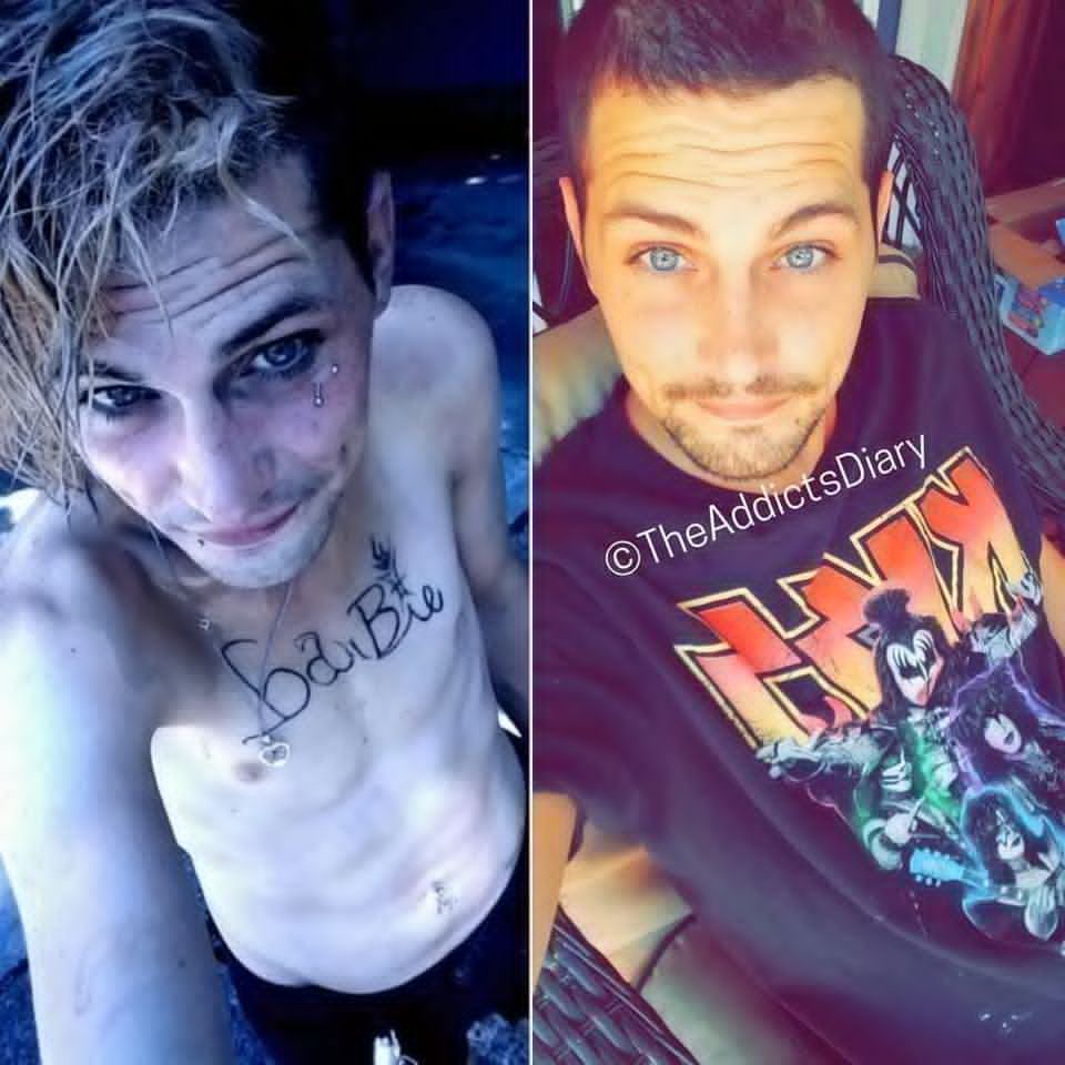 I decided to get clean. I've now been sober for 17 months and 15 days. Before and after image ❤️