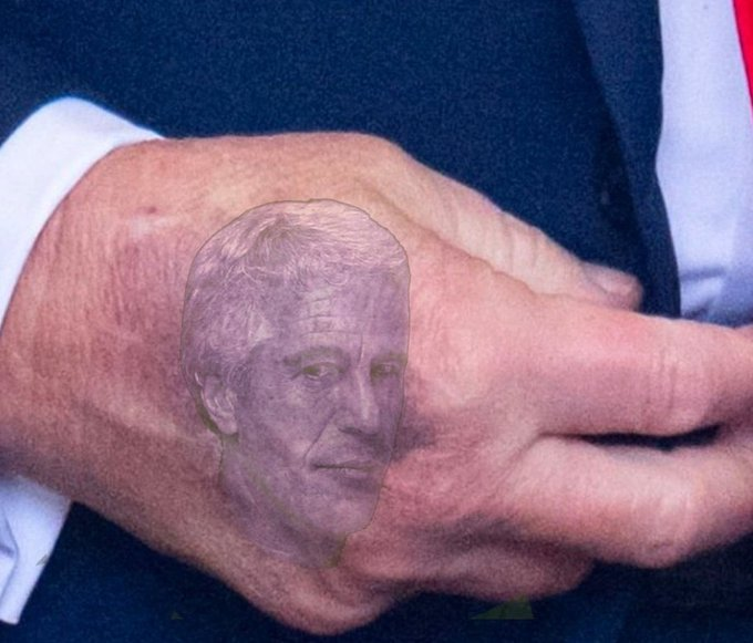 Everyone has been saying the bruise on Trump's hand is bad but I didn't know it was this bad. You can run but you can't hide from Jeffrey, Donald! Oh and today would be a great day to #ReleaseTheEpsteinFiles