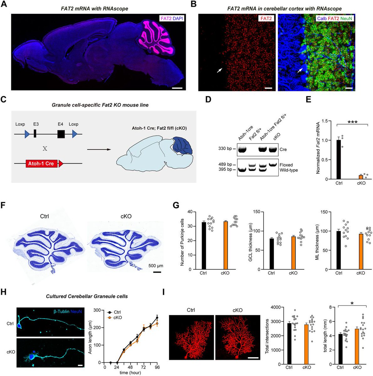 SfNJournals's tweet photo. #JNeurosci: Wang, Pu, Miao, et al. identify FAT Atypical Cadherin 2 (FAT2), a protein linked to ataxia &amp; autism that works with Cbln1, as essential for preserving synaptic integrity &amp; driving digging behavior in mice. @Wohrlab @ShenzhenBayLab @BoZhangLab
https://t.co/q97WGQHlYV https://t.co/a5UfAp2rPR