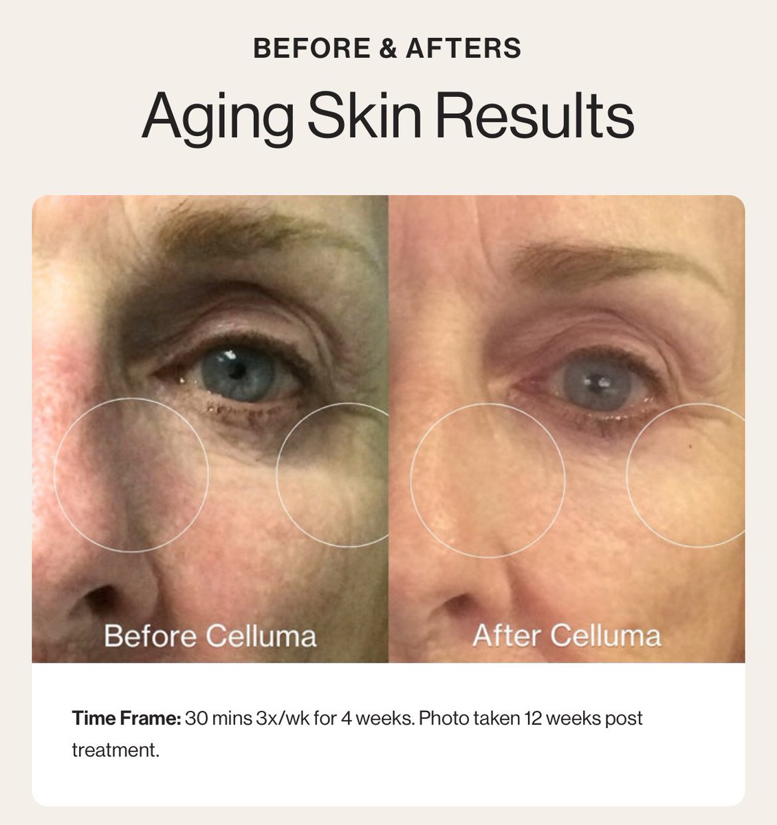SkinInnovation1's tweet photo. ✨ Science meets skincare. LED Light Therapy is a scientifically proven treatment that utilizes specific wavelengths of light to stimulate cellular activity. Benefits include reduced inflammation, enhanced wound healing, increased collagen production, and management of acne. https://t.co/pZEOQZbZjn