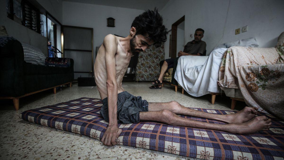 Gaza: pourquoi la reconnaissance de l'état de famine par l'ONU ne changera rien  👉 bit.ly/3JvHmQ9