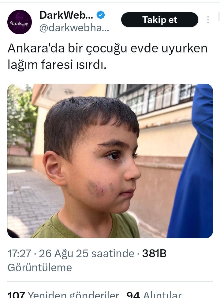 Serap Ulusoy 🦋 (@srpulsy) on Twitter photo Köpekleri kedileri toplayınca evlerinize kadar fareler girecek çocuklarınızı yiyecek demiştik🤷♀️
<a href="/darkwebhaber/">DarkWeb Haber</a> Köpekleri kedileri toplayınca evlerinize kadar fareler girecek çocuklarınızı yiyecek demiştik🤷♀️
<a href="/darkwebhaber/">DarkWeb Haber</a>