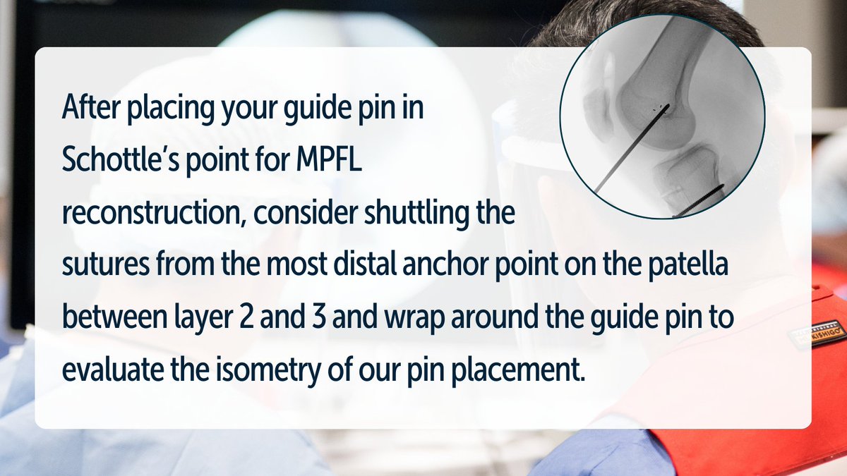 AANAORG's tweet photo. Dr. @RJuddRobinsMD shares his #TipsforTuesday on MPFL reconstruction:
“After placing your guide pin in Schottle’s point for MPFL reconstruction, consider shuttling the sutures from the most distal anchor point on the patella between layer 2 and 3 and wrap around the guide pin to evaluate the isometry of our pin placement. If the suture tightens in flexion, move the pin distal. Conversely, if the graft tightens in extension, adjust the pin anteriorly to balance your isometry. Checking isometry prior to drilling the femoral tunnel and cutting the graft will ensure a successful and balanced MPFL reconstruction!”
