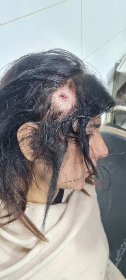 SabeeKazmi786's tweet photo. یہ پاکستان کی بیٹیوں ،بہنوں کے ساتھ سلوک کیا گیا فرخندہ کوکب کو ساتھ  10سال کی سزا بھی سنائی گئی ہے۔ یہ قوم کبھی نہیں بھولے گی یہ ظلم و ستم https://t.co/oU84gMIqOP
