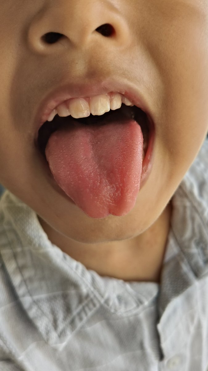 foolamak's tweet photo. Kids: the easiest audience. Trigger their amusement &amp; strangers get free tongue shows 🤪
#Parenting #ChildhoodMagic #lifewithkids #parentinghumor https://t.co/NmmCmz9wYs