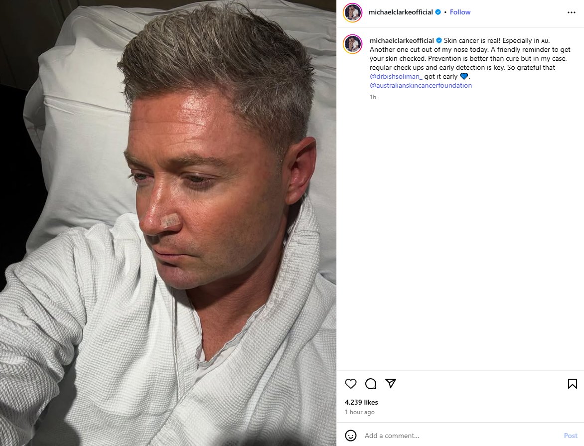 Michael Clarke with a reminder of the importance of regular skin checkups. So relevant to cricket players &amp; fans.

"Skin cancer is real! Especially in 🇦🇺. Another one cut out of my nose today. Prevention is better than cure but in my case, regular check ups &amp; early detection is