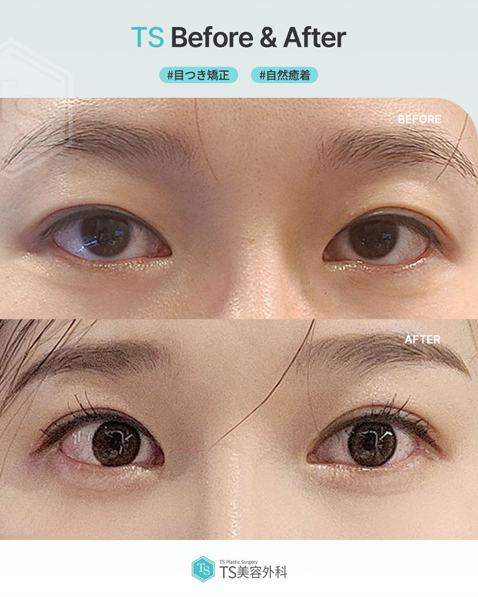 顔の美容外科手術 顔の美容外科手術 顔の美容外科手術 | 飯田秀夫 |本 |