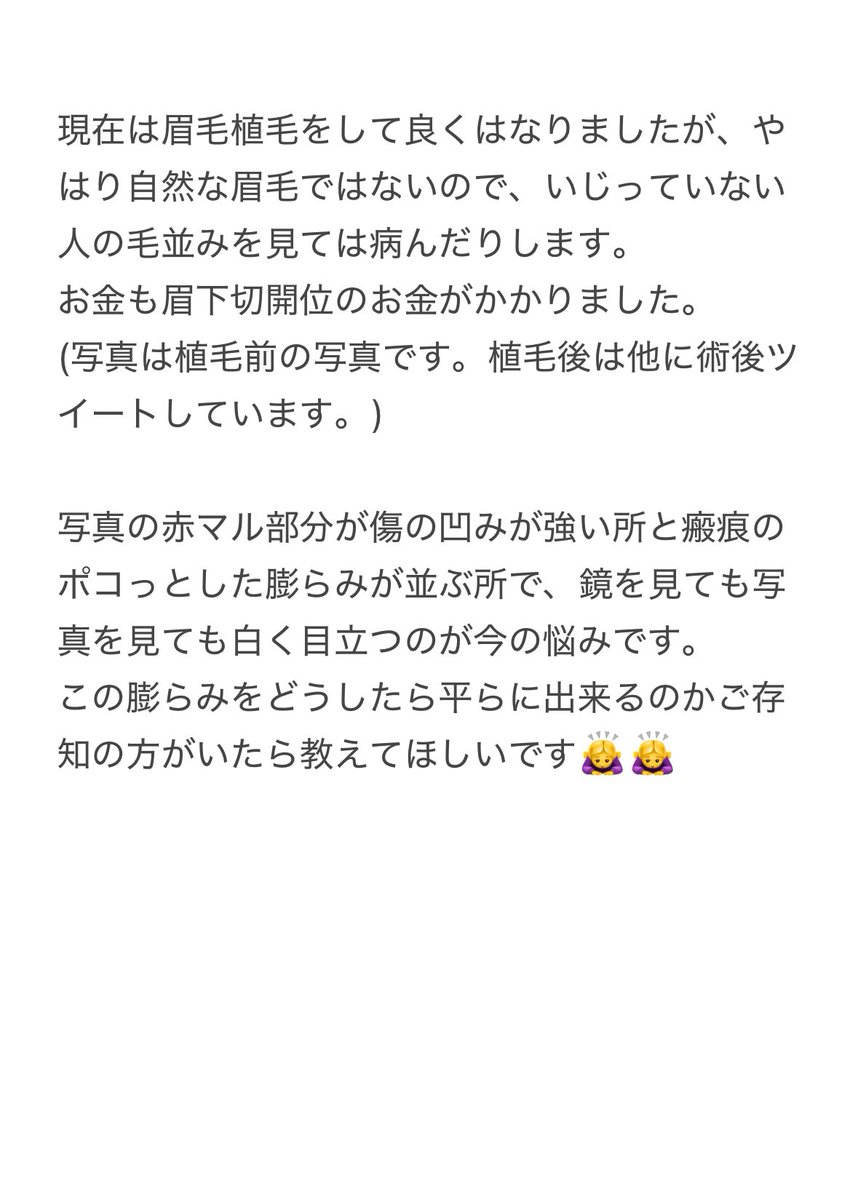 mimimi_update's tweet photo. 眉下切開 #眉下切開 https://t.co/Wx8kTBLm4z