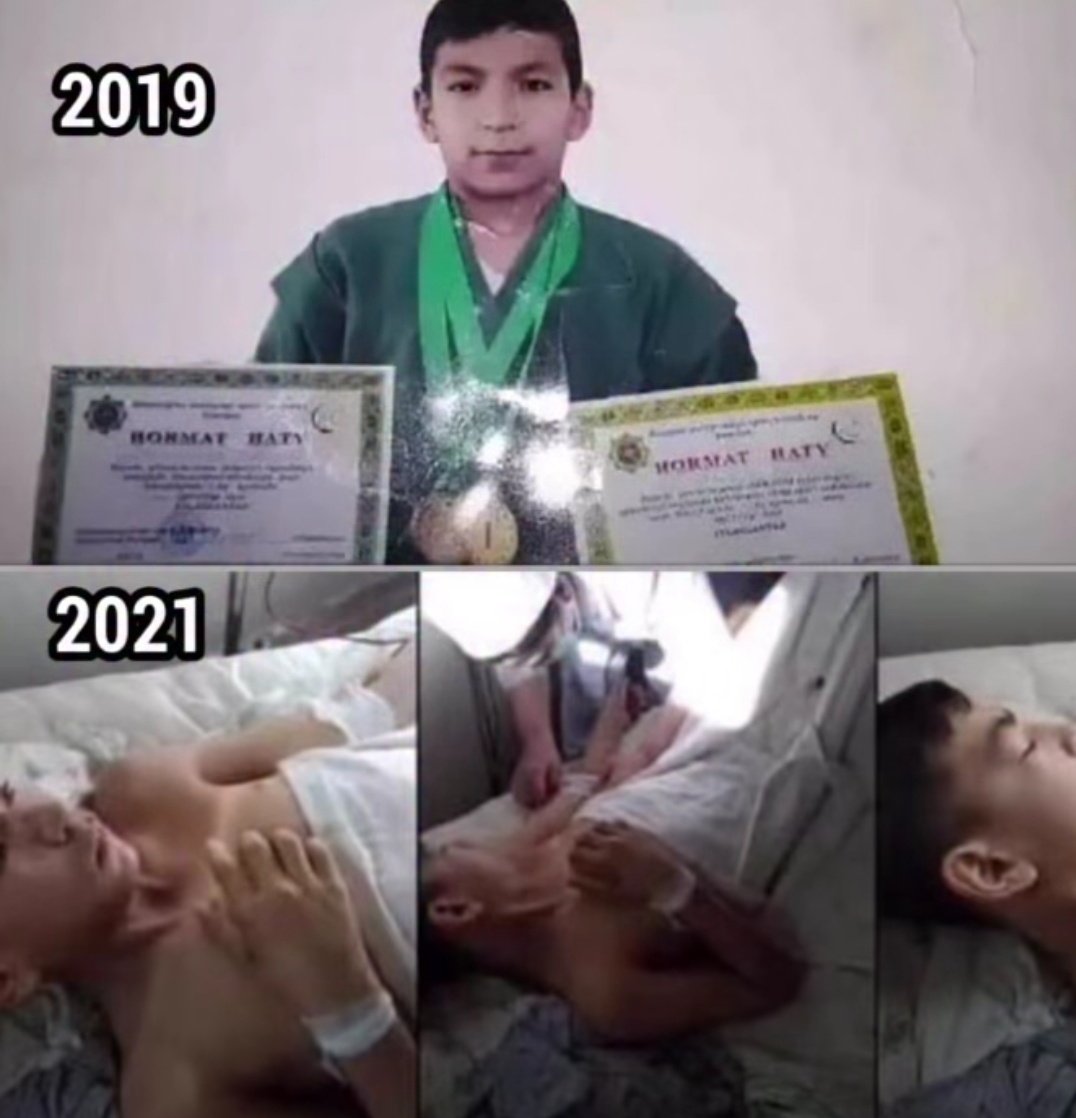 Türkmenistan'da 14 yaşında ki Judocu Süleyman Tursunbayev'den finalde Cumhurbaşkanının yeğenine yenilmesi istendi. Bunu kabul etmeyen ve yeteneğini sergileyen Süleyman maçı kazandıktan birkaç gün sonra dövülerek öldürüldü