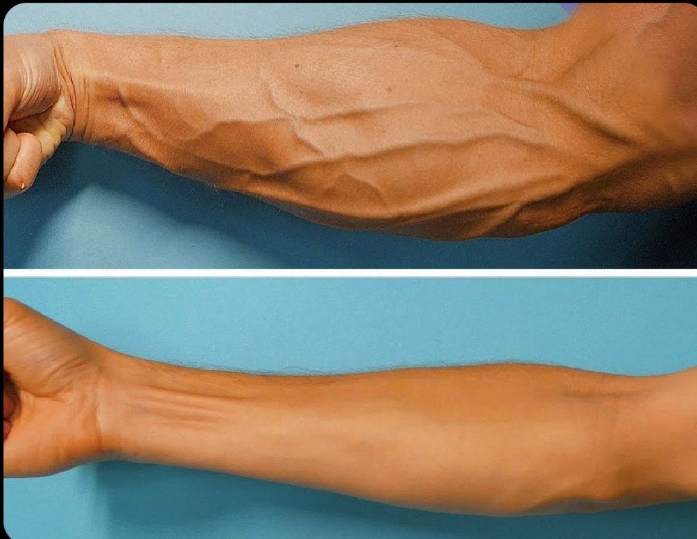 7 Best exercises to grow Arms &amp; Biceps 🔥👇💯