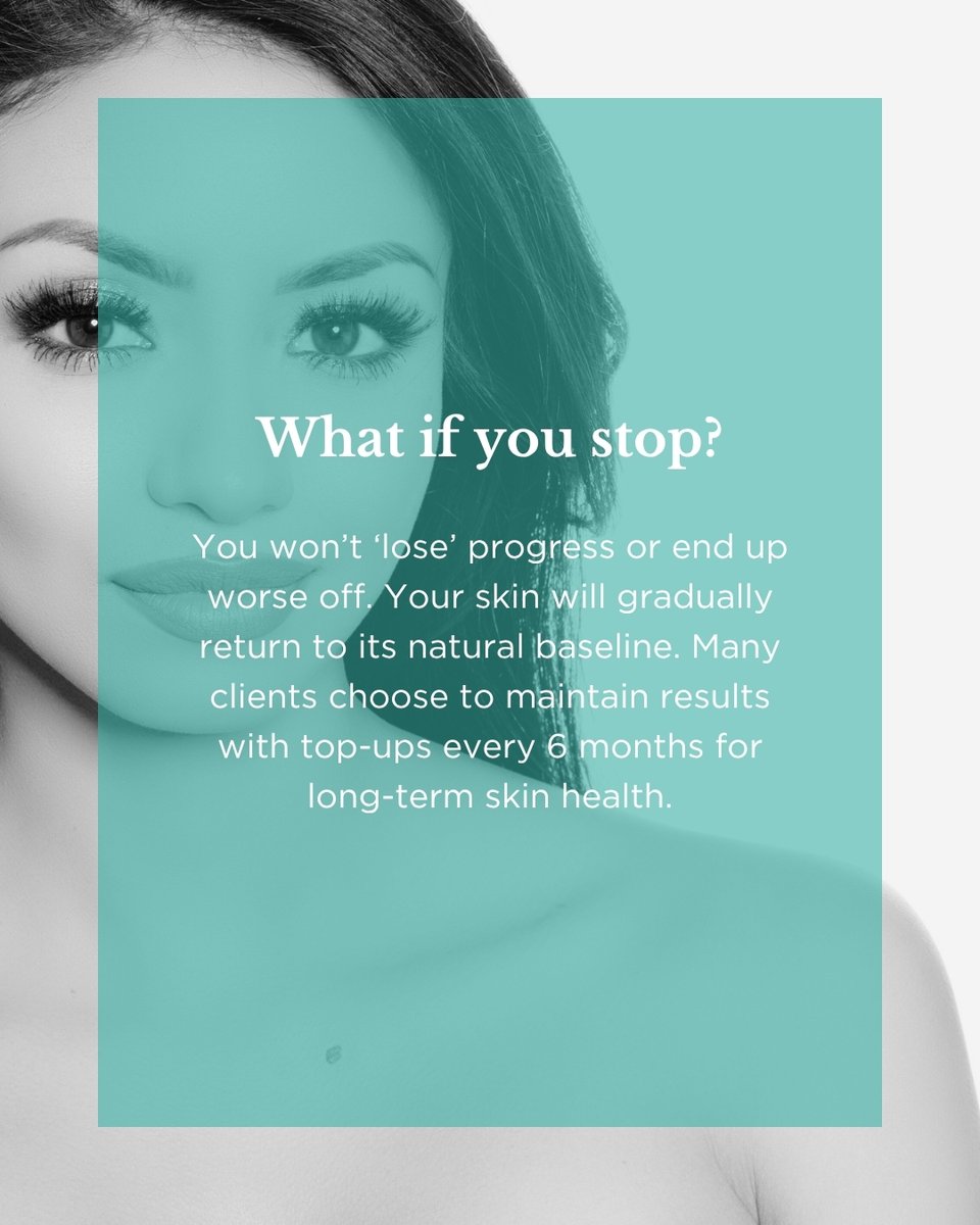 💧 3 things to know about #Profhilo 💧

1. Hydrates from within, firms, smooths &amp; boosts #glow.
2. Start in your 30s (or late 20s for prevention).
3. You won’t ‘lose’ progress if you stop – your #skin returns to its baseline.

Book a consultation today – rpaesthetics.co.uk