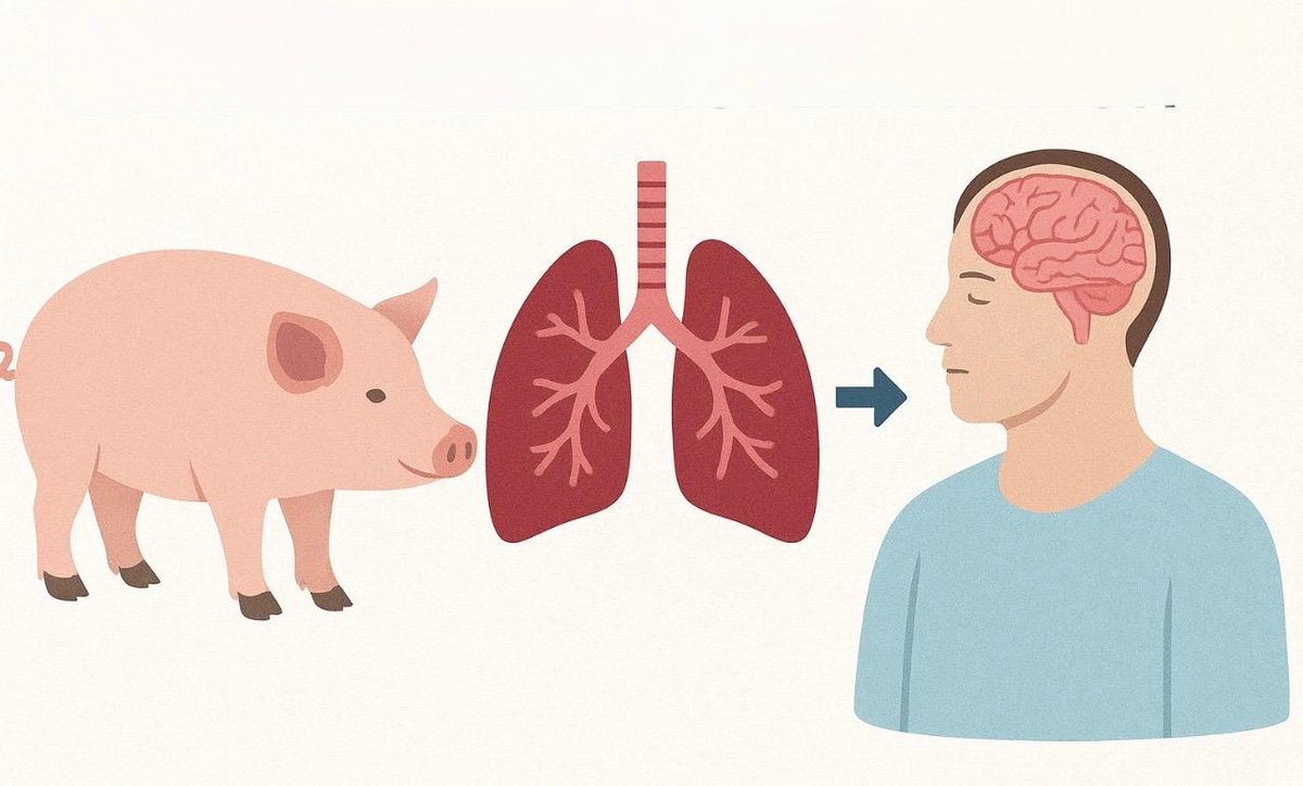 MedMultilingua's tweet photo. Pig-to-Human Lung Xenotransplantation: A Milestone and Its Challenges
By Dr. Marco V. Benavides Sánchez. August 27, 2025
https://t.co/HQIA1KNAYb
https://t.co/o5QlISiuXG
#ArtificialIntelligence #Medicine #Surgery #Medmultilingua https://t.co/qgi9iI2v0l