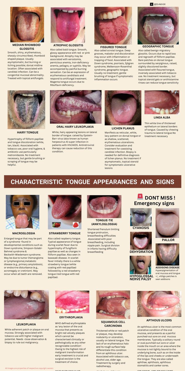 Tongue vs Diseases 🧣

🗣️🗣️🗣️