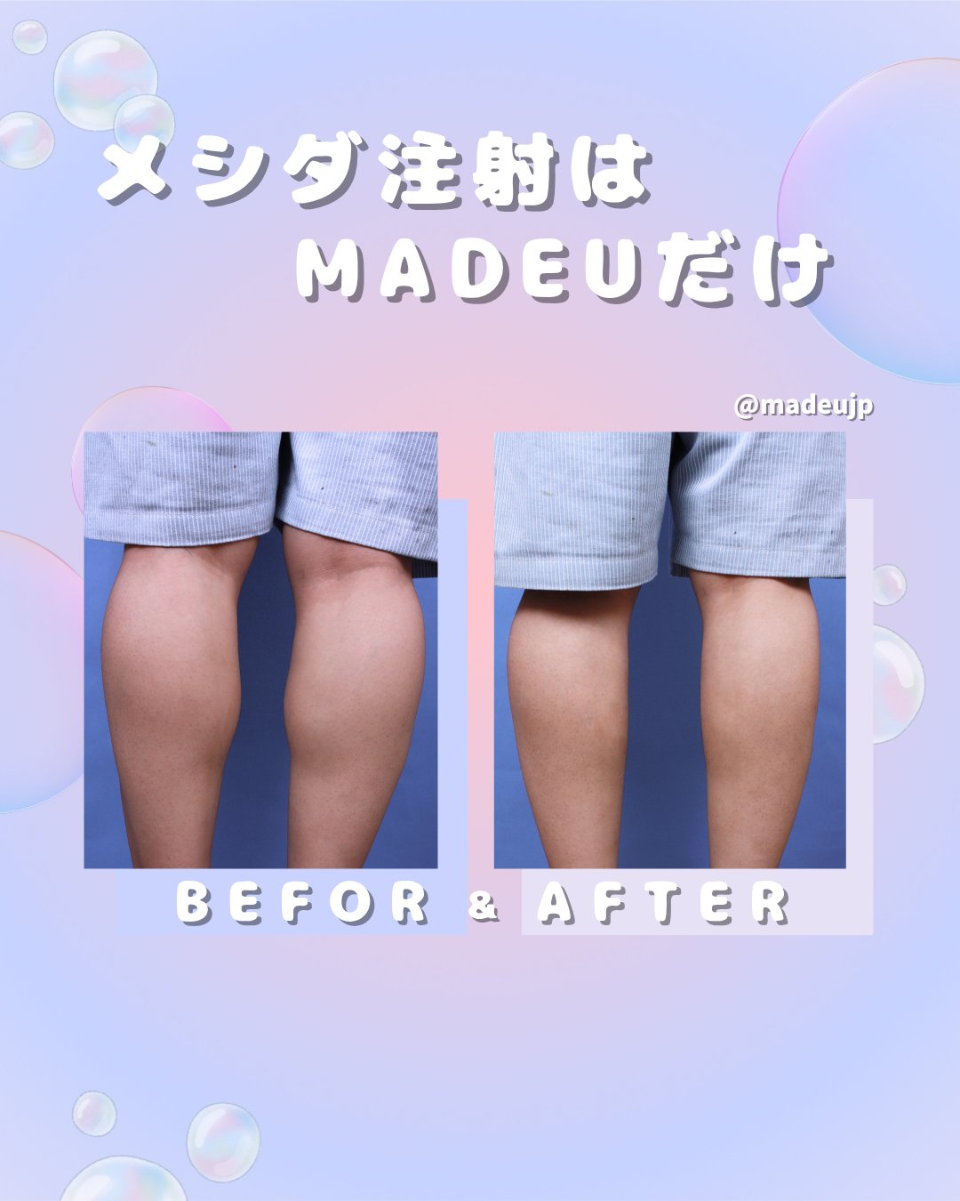 メイドユー　メシダ メイドユー医院 on X: 