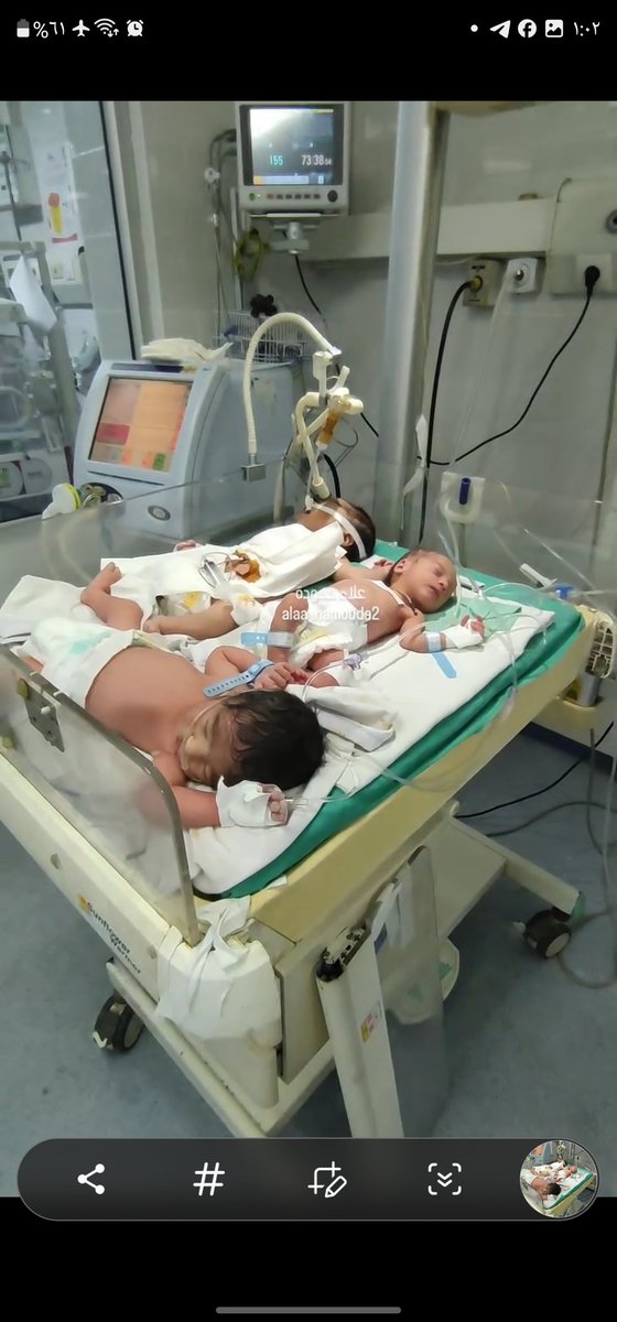 🍼💔 أطفال يتكدسون في الحضانة… صورة تختصر المجاعة وانهيار النظام الصحي في غزة

في مشهدٍ يفطر القلب، نرى أطفالًا حديثي الولادة متكدسين في حضانة واحدة، يتشاركون الأجهزة والأنفاس، في محاولة يائسة لإنقاذ حياتهم.

🔴 هذه ليست مجرد أزمة طبية، بل انعكاس مباشر للمجاعة وانهيار المنظومة