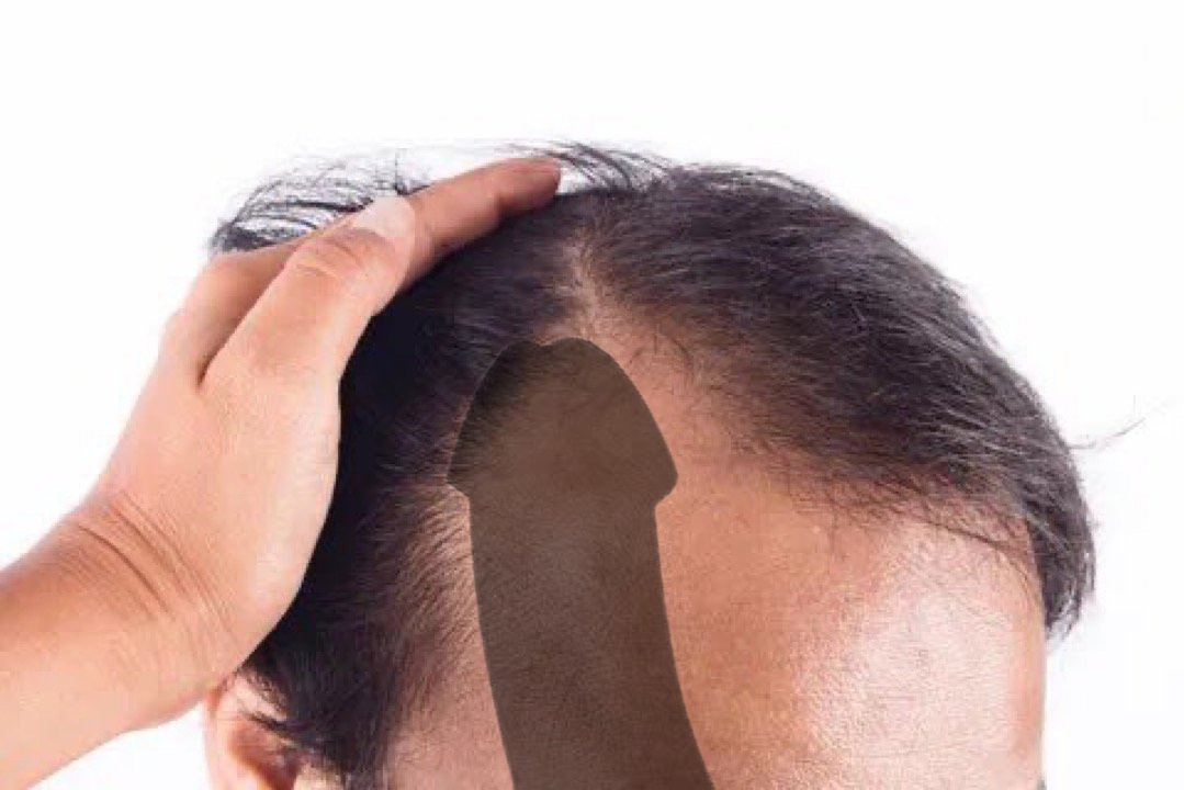 <a href="/jeremybtc/"></a> Stay bald now, stay rich later, $MEATY got you 🚀🥩