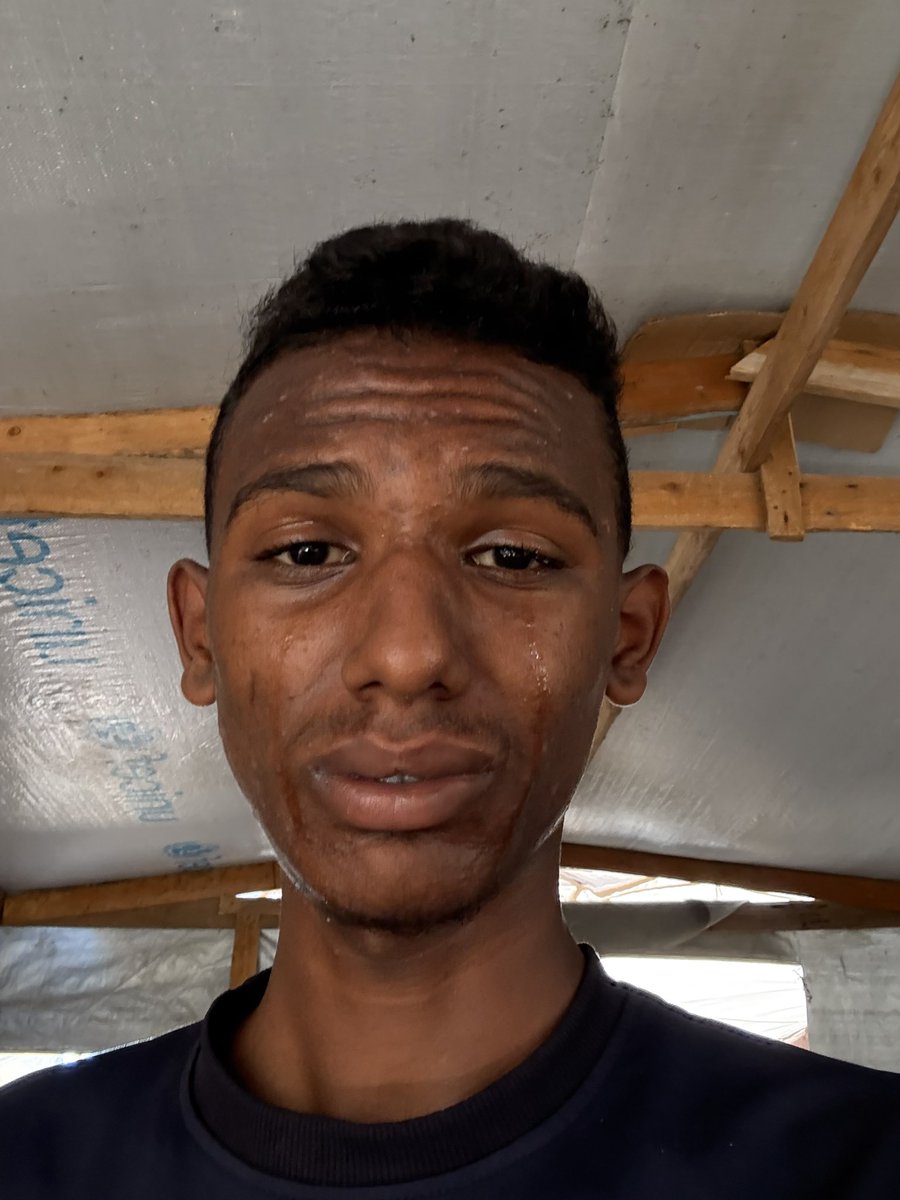 3 replies — even dots — can break the algorithm 

gofund.me/64fec104