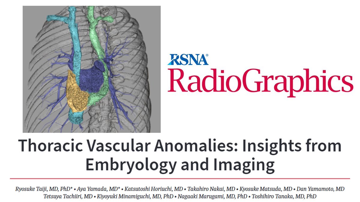 thurlcledera's tweet image. 🚨Confused about Vascular Anomalies in the chest? Then let’s check out this new article by Taiji et al.
Thread below👇
#RGphx @cookyscan1 @teachplaygrub @RadioGraphics @RadG_Editor

Thoracic Vascular Anomalies: Insights from Embryology and Imaging
bit.ly/4lQ1o53