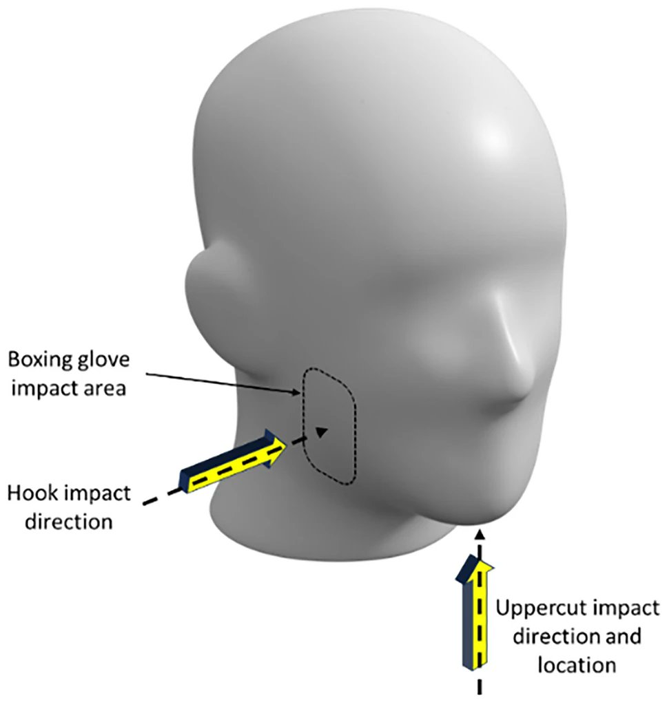 Efforts to prevent head injuries in sports increasingly depend on instrumented mouthguards (iMGs), making it essential to understand how well these devices capture real impacts.

Toward this need, engineers tested two iMGs – one from Prevent Biometrics and one from Diversified