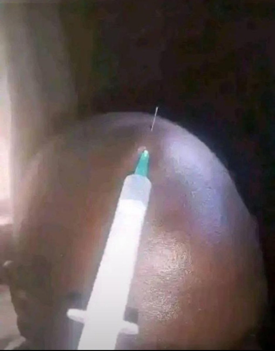 Quand t'es atteint de la malaria cérébrale

L'infirmière :