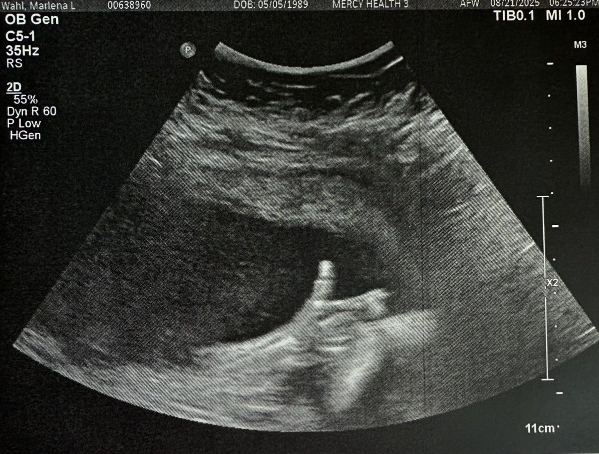 David “Durskii” Wahl tweet media