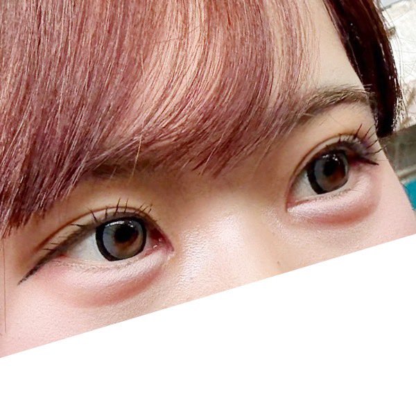 R02jly's tweet photo. TOBE美容外科さんで、埋没＋目頭切開をして頂いてから5ヶ月が経ちました✨

二重は毎日アイプチしていたので化粧が時短になりました!!
目頭もダウンタイム明けてから時間が経って、とても綺麗になり写真を撮るのが楽しいです🩷

ありがとうございました🙏🏻
 #TOBE美容外科 @tobeps_jp https://t.co/kz6zLkfHu7