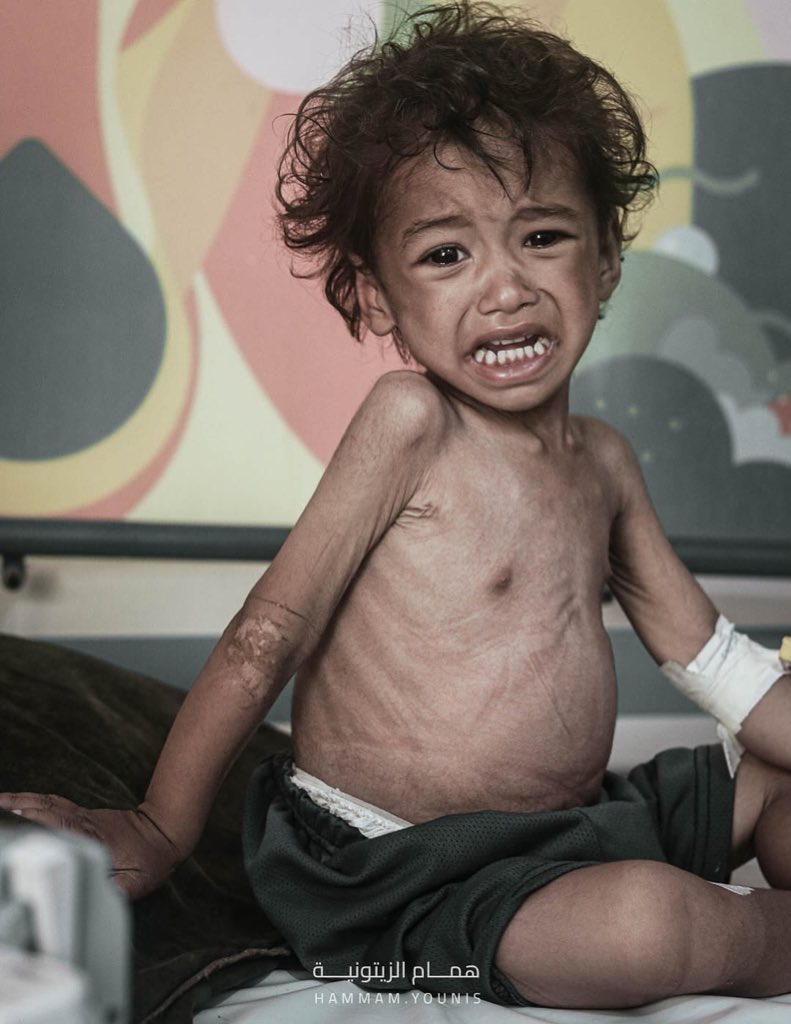 If you’re scrolling, PLEASE leave a dot.

STARVATION.