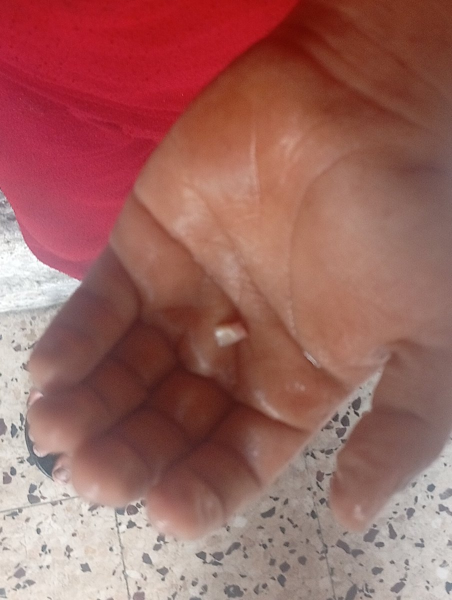 hmd_mhmd9832's tweet image. My little brother with the little heart is in crazy pain He is suffering from tooth decay due to lack of food, medicine and calcium He is suffering from strife We need help to save his life🙏😭
 
3 replies — even dots — can break the
 algorithm 😭
chuffed.org/project/127878