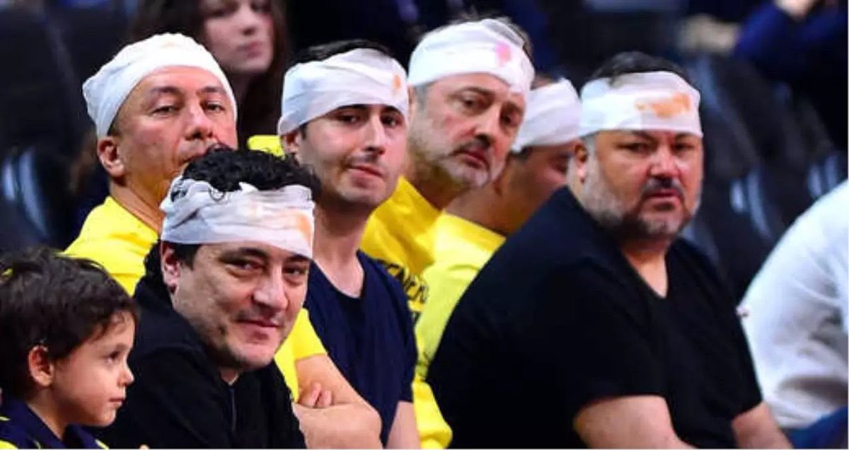 Şu Fotoğraftan Sonra Bir Adım İlerleyemediler Amg...