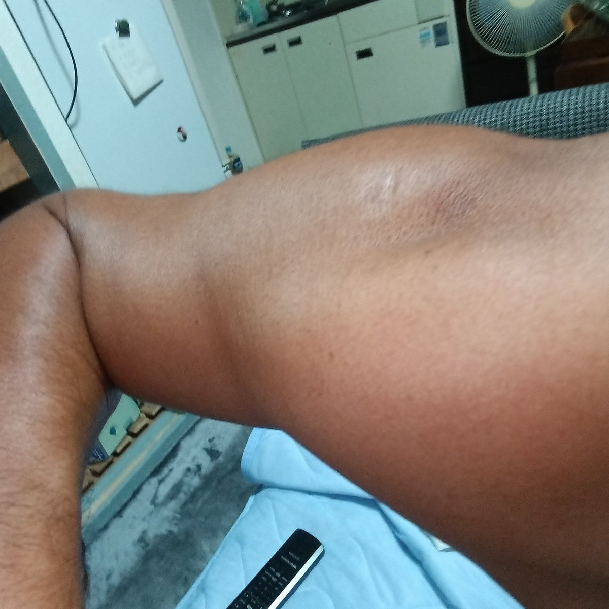 #MC
#DeadCats
#バイカー
#チョッパー
今年
やっと痩せて来て
３８in迄イッてたLevi’sが
３４in迄絞れてきたんですが
痩せて来ると筋肉の残骸がハッキリして来るね😅笑
ボクサー上がりの子に２回
ミ………さん健闘ッすか😳
と
サンドバッグ殴り続けた仲間と勘違いされた
筋肉の付き方😸笑