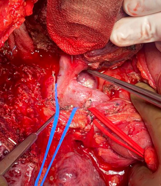 Riccardo De Carlis tweet media