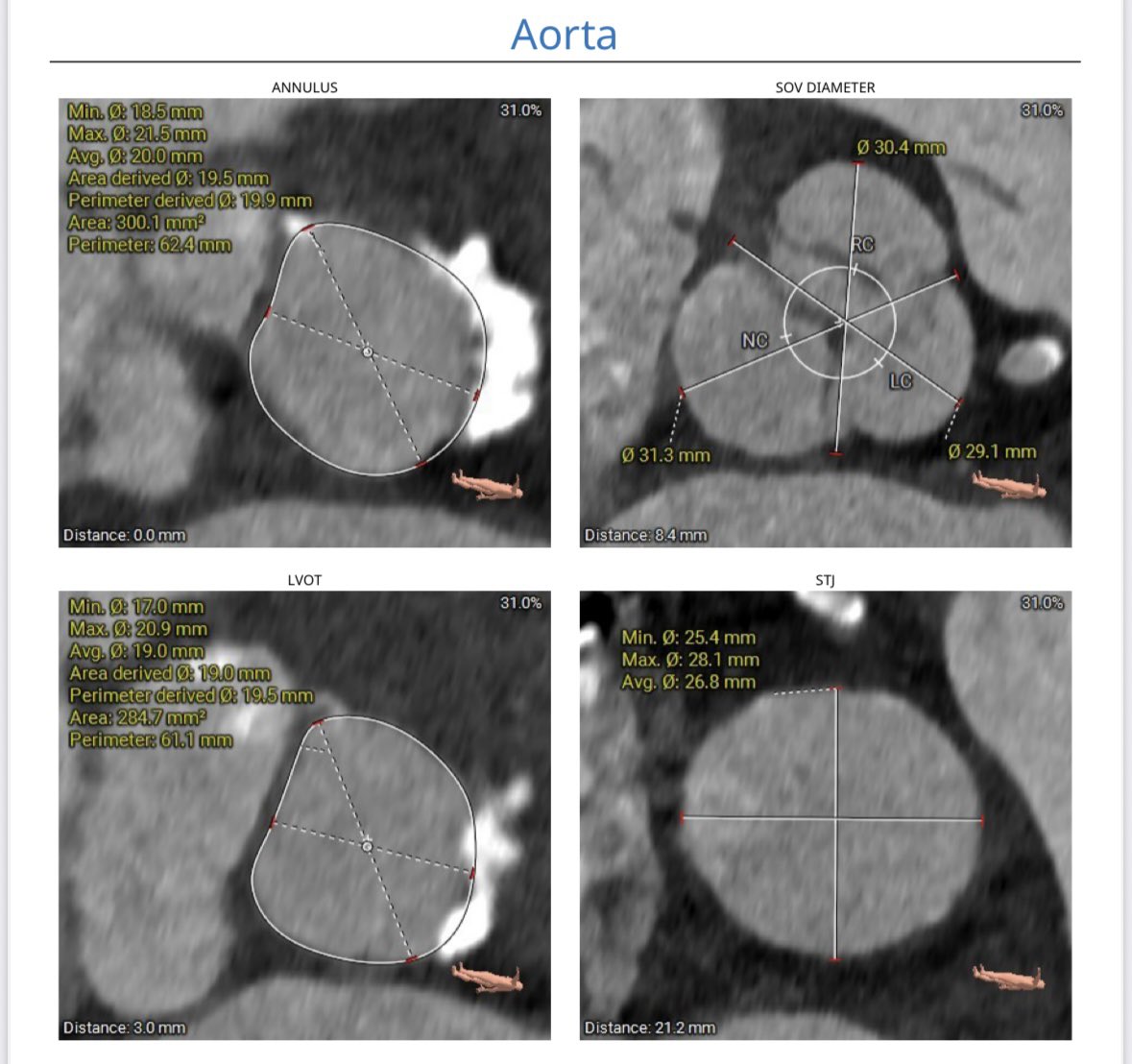 Atul Mathur tweet media
