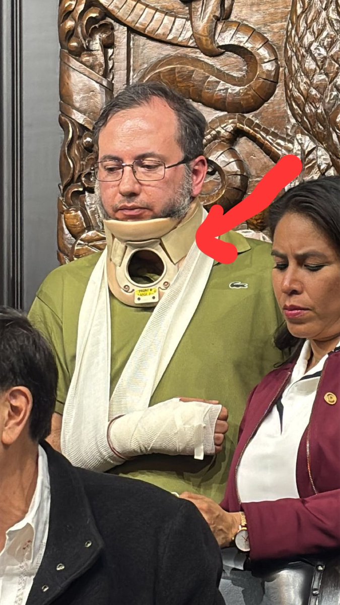 Esto es muy grave, le ponen una venda alrededor del cuello qué en teoría está lastimado. Me preocupa qué ni en el Senado tienen atención médica de calidad. (1/2)