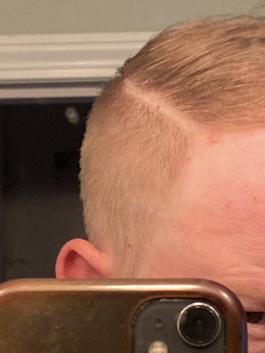 EricRardPhoto's tweet photo. Never using @GreatClips ever again. It’s always hit or miss &amp; today was beyond a miss. She not only took most of my hair off even tho I said “just a touch up”but she gave me a 1/4 inch part line! 🤬🤬🤬Thanks for the weeks of embarrassment at work! https://t.co/dIDaumvFRB