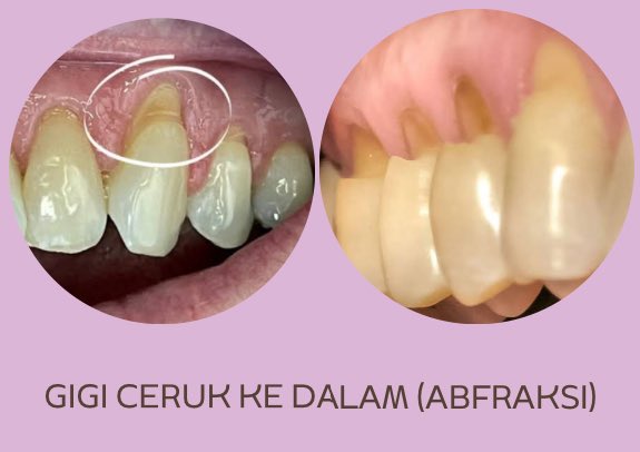 koas gigi jakpus 🦷🚀 tweet media