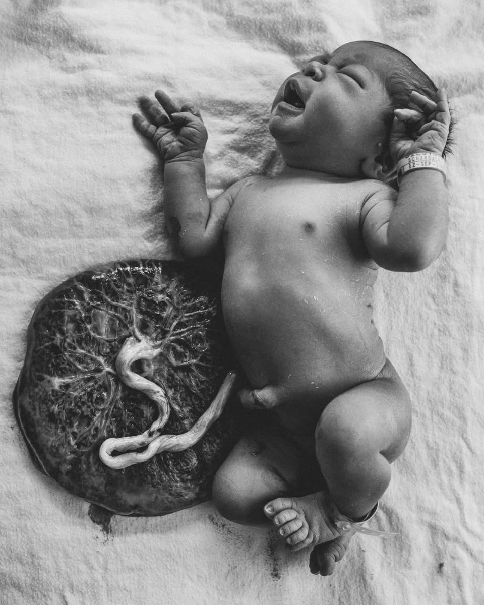 Did you know the placenta is the only

'single use' organ that the body develops?

Women's bodies are pretty damm incredible... not only do they grow tiny humans, but a whole organ for each pregnancy.

It's no wonder expectant Mumma's can feel so tired in the first trimester!