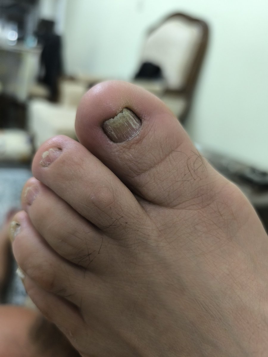 بلا رمزی اگه انگشت شصت بود: