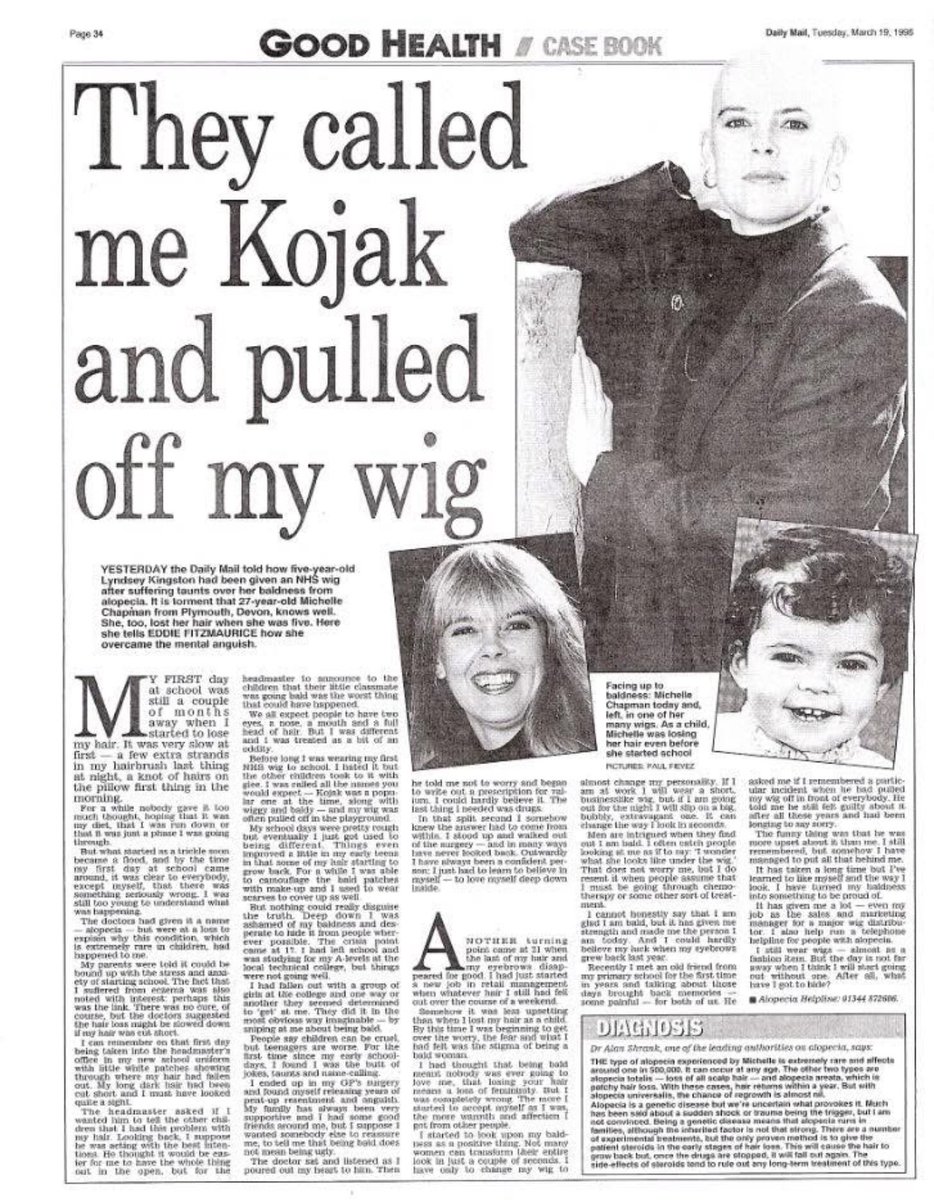 michellalopecia's tweet photo. How time flies. 29 years since I went topless in the national press 🤣 Before the days of social media, this was the only way I could think of getting the message out there to the many people living with alopecia and hair loss. #Alopecia #alopeciaawarenessmonth https://t.co/qXgLQixLME