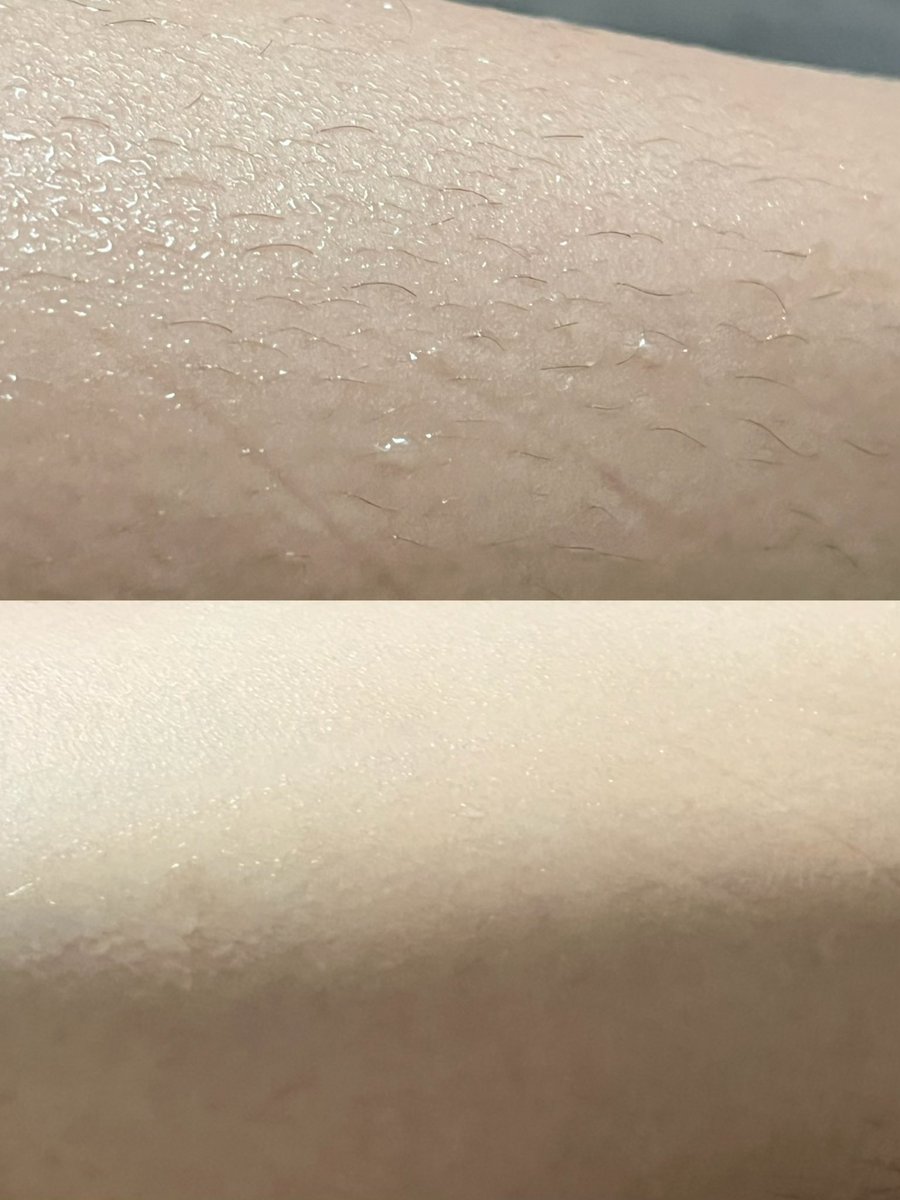 แก มีดโกน Schick อันนี้ ใช้ดีมากกก งง จากใจคนไม่มีงบไปเลเซอร์ขา 🥲 รอบ ๆ เป็นหัวสบู่ มี 4 ใบมีด โกนละเนียนกริ้บบบ ชั้นลาก ๆ ไปไม่มีเทคนิคอะไรเลย ชั้นแบบ ห้ะ โคตรเนียน อ่อนโยนมาก มีดปกติโกนขาแล้วคันยุบยิบ แต่อันนี้สูตร Aloe vera คือดีมากกก เปิดโลกสุด ๆ 😭
#SchickIntuition #มีดโกน