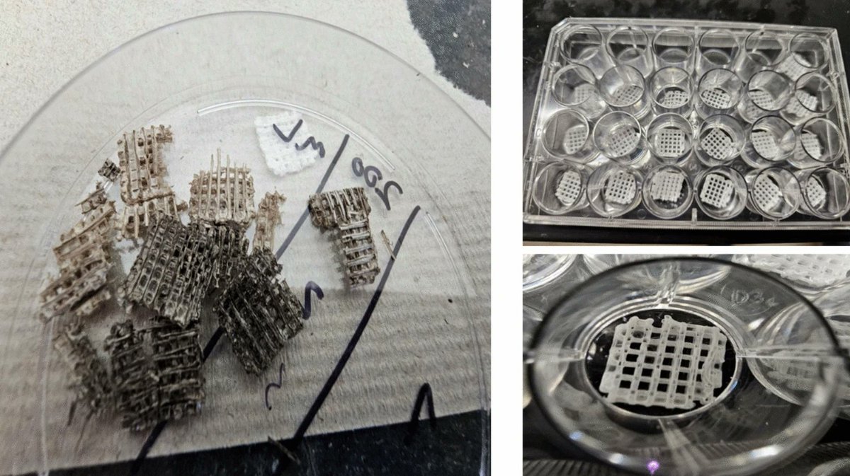 Rebuilding damaged bone tissue is a long-standing challenge in medicine, and current manufacturing techniques often fall short in precision, consistency, or scalability.

A new study presents a novel method for producing bone scaffolds made of poly(DL-lactide-co-glycolide) and