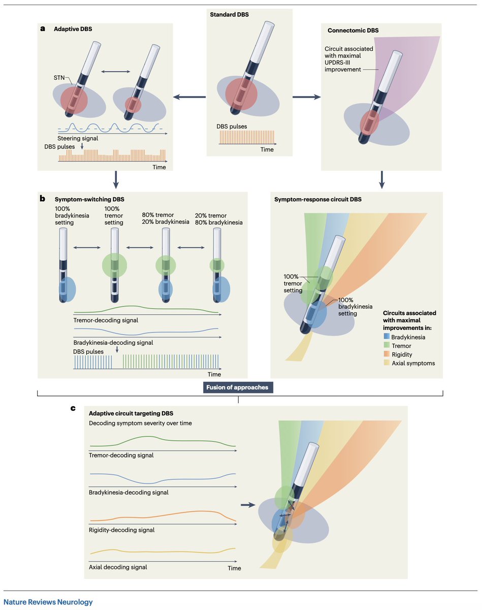 Andreas Horn (@andreashorn_) on Twitter photo Can we fuse adaptive and connectomic DBS?
<a href="/neumann_wj/">Julian Neumann</a> & I say yes. Out in <a href="/NatRevNeurol/">Nat Rev Neurology</a>:
nature.com/articles/s4158…
Thread here: shorturl.at/NtPMf Can we fuse adaptive and connectomic DBS?
<a href="/neumann_wj/">Julian Neumann</a> & I say yes. Out in <a href="/NatRevNeurol/">Nat Rev Neurology</a>:
nature.com/articles/s4158…
Thread here: shorturl.at/NtPMf